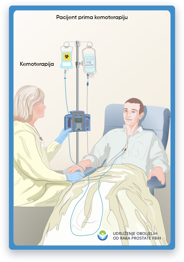 Ova ilustracija prikazuje pacijenta koji prima kemoterapiju. Pacijent se nalazi u stolici sa kapanjem
             povezan sa njihovom rukom. Medicinski radnik stoji pored pacijenta i prati njegovo liječenje.
             Ilustracija takođe može prikazati drugu medicinsku opremu, kao što je pumpa za hemoterapiju ili vrećica za infuziju.
             Hemoterapija je tretman za rak koji koristi moćne lijekove za ubijanje stanica raka.
             Dok kemoterapija može biti efikasna u liječenju raka, može uzrokovati i nuspojave kao što su mučnina, gubitak kose,
             i umor. Pacijenti koji primaju kemoterapiju možda će morati proći više sesija liječenja u periodu od nekoliko
             nedeljama ili mesecima, u zavisnosti od vrste i stadijuma raka.